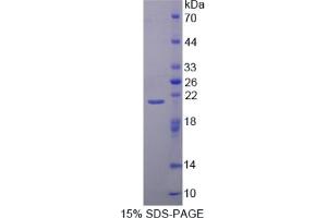 SDS-PAGE of Protein Standard from the Kit  (Highly purified E. (CAPN1 Kit ELISA)