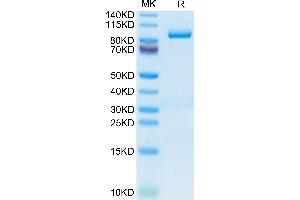Mouse Periostin/OSF-2 on Tris-Bis PAGE under reduced condition. (Periostin Protein (POSTN) (AA 24-811) (His tag))