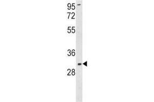 Western blot analysis of SOD3 antibody and K562 lysate.