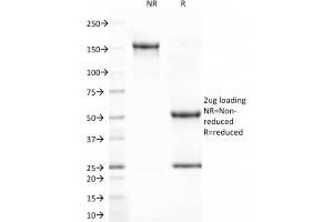 SDS-PAGE Analysis Purified CD80 Mouse Monoclonal Antibody (C80/2723). (CD80 anticorps  (AA 35-142))