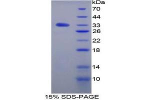 SDS-PAGE analysis of Rat TGFbR3 Protein. (TGFBR3 Protéine)