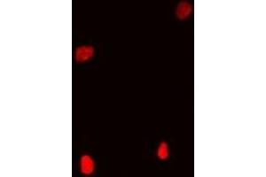 Immunofluorescent analysis of Coilin staining in Hela cells. (Coilin anticorps)