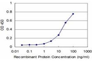 Detection limit for recombinant GST tagged RIPK4 is approximately 3ng/ml as a capture antibody. (RIPK4 anticorps  (AA 675-784))