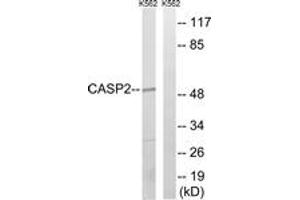 Western blot analysis of extracts from K562, using Caspase 2 (Ab-157) Antibody. (Caspase 2 anticorps  (AA 123-172))