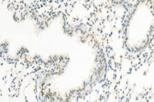 Immunohistochemistry analysis of paraffin-embedded mouse lung using,PNN (ABIN7075083) at dilution of 1: 1200