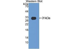 Detection of Recombinant ACTN2, Mouse using Polyclonal Antibody to Actinin Alpha 2 (ACTN2) (ACTN2 anticorps  (AA 1-254))