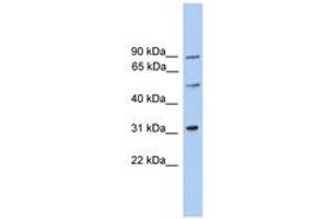 Image no. 1 for anti-Centrosomal Protein 57kDa-Like 1 (CEP57L1) (AA 141-190) antibody (ABIN6746415) (CEP57L1 anticorps  (AA 141-190))