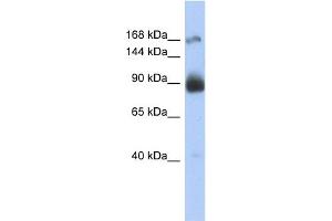 WB Suggested Anti-INSR Antibody Titration:  0. (Insulin Receptor anticorps  (Middle Region))