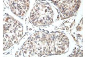 Immunohistochemical staining of formalin-fixed paraffin-embedded human fetal testis tissue showing nuclear staining with RBBP6 polyclonal antibody  at 1 : 100 dilution. (RBBP6 anticorps  (N-Term))