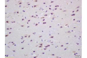 Formalin-fixed and paraffin embedded rat brain labeled with Anti Transglutaminase Polyclonal Antibody (ABIN719996), Unconjugated at 1:200, followed by conjugation to the secondary antibody and DAB staining (Transglutaminase anticorps  (AA 461-560))