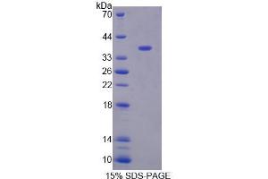 SDS-PAGE (SDS) image for 5'-3' Exoribonuclease 1 (XRN1) (AA 1394-1706) protein (His tag) (ABIN6239389)