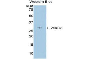 Western Blotting (WB) image for anti-Matrix Metallopeptidase 16 (Membrane-inserted) (MMP16) (AA 351-557) antibody (ABIN1859850) (MMP16 anticorps  (AA 351-557))