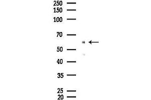 Western blot analysis of lysates from A2780 cells(starvation 24h treatment), using SLC7A10 Antibody at 1/1000 dilution.