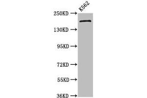 Western Blot Positive WB detected in: K562 whole cell lysate All lanes: PSME4 antibody at 4. (PSME4 anticorps  (AA 105-198))