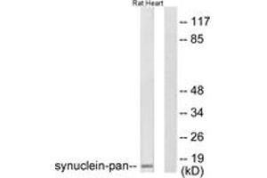 Western blot analysis of extracts from rat heart cells, using Synuclein-pan Antibody. (Synuclein anticorps  (AA 15-64))