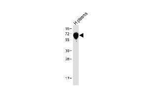 Anti-SERPINA6 Antibody (Center) at 1:1000 dilution + Human plasma tissue lysate Lysates/proteins at 20 μg per lane.