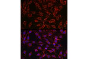 Immunofluorescence analysis of C6 cells using MARCKS Rabbit pAb (ABIN6134393, ABIN6143555, ABIN6143556 and ABIN6214033) at dilution of 1:100 (40x lens). (MARCKS anticorps  (AA 1-100))