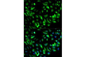 Immunofluorescence (IF) image for anti-Glycyl-tRNA Synthetase (GARS) antibody (ABIN1876623) (GARS anticorps)