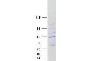 Validation with Western Blot
