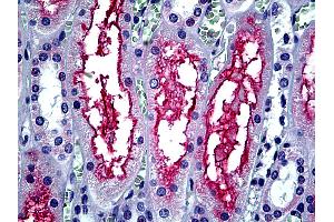 Anti-ACE-2 antibody IHC of human kidney. (ACE2 anticorps  (Internal Region))