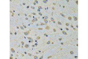 Immunohistochemistry of paraffin-embedded Rat brain using DARS Polyclonal Antibody at dilution of 1:100 (40x lens).
