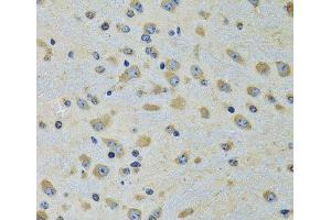 Immunohistochemistry of paraffin-embedded Rat brain using DARS Polyclonal Antibody at dilution of 1:100 (40x lens). (DARS anticorps)