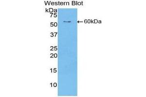Western Blotting (WB) image for anti-Cartilage Intermediate Layer Protein, Nucleotide Pyrophosphohydrolase (CILP) (AA 603-846) antibody (ABIN1858408) (CILP anticorps  (AA 603-846))