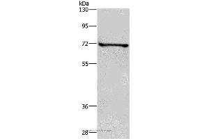 Western blot analysis of HT-29 cell, using TRIM29 Polyclonal Antibody at dilution of 1:400 (TRIM29 anticorps)
