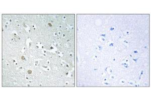 Immunohistochemistry analysis of paraffin-embedded human brain tissue using PLA1A antibody. (PLA1A anticorps  (C-Term))