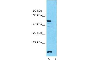 Host:  Rabbit  Target Name:  SLC10A1  Sample Type:  HT1080  Lane A:  Primary Antibody  Lane B:  Primary Antibody + Blocking Peptide  Primary Antibody Concentration:  1ug/ml  Peptide Concentration:  5ug/ml  Lysate Quantity:  25ug/lane/lane  Gel Concentration:  0. (SLC10A1 anticorps  (Middle Region))