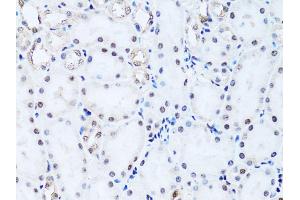 Immunohistochemistry of paraffin-embedded rat kidney using Histone H2B antibody (ABIN3015764, ABIN3015765, ABIN3015766 and ABIN6219109) at dilution of 1:100 (40x lens). (Histone H2B anticorps  (AA 1-126))
