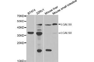 Western blot analysis of extracts of various cell lines, using LGALS8 antibody. (LGALS8 anticorps)