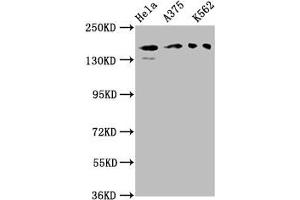 Western Blot Positive WB detected in: Hela whole cell lysate, A375 whole cell lysate, K562 whole cell lysate All lanes: PARD3 antibody at 3 μg/mL Secondary Goat polyclonal to rabbit IgG at 1/50000 dilution Predicted band size: 152, 142, 147, 139, 114, 109, 110, 150 kDa Observed band size: 152 kDa (PARD3 anticorps  (AA 1068-1356))