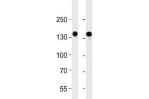 VEGFR3 antibody western blot analysis in 293 and A549 lysate.