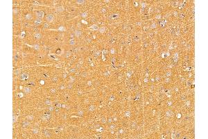 ABIN7094749 and ABIN7098800 at 1/100 staining Rat brain tissue by IHC-P.