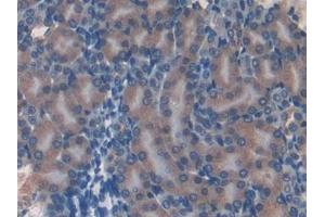 Detection of EIF3A in Mouse Kidney Tissue using Polyclonal Antibody to Eukaryotic Translation Initiation Factor 3A (EIF3A)