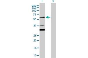 Western Blot analysis of CUGBP2 expression in transfected 293T cell line by CUGBP2 MaxPab polyclonal antibody. (CELF2 anticorps  (AA 1-521))