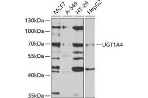 Western blot analysis of extracts of various cell lines, using UGT1 antibody (ABIN6132770, ABIN6149897, ABIN6149898 and ABIN6221194) at 1:1000 dilution. (UGT1A4 anticorps  (AA 29-150))