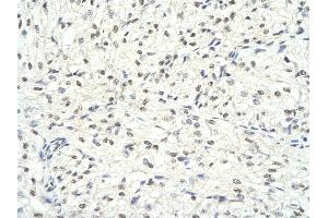 Rabbit Anti-HDAC1 antibody        Paraffin Embedded Tissue:  Human Heart cell   Cellular Data:  Epithelial cells of renal tubule  Antibody Concentration:   4.