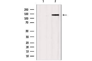 Western blot analysis of extracts from mouse brain, using GAK Antibody.