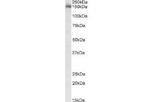 ABIN571091 (1µg/ml) staining of Human Cerebellum lysate (35µg protein in RIPA buffer). (CSMD1 anticorps  (Internal Region))