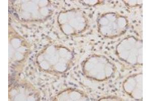 Immunohistochemistry (Paraffin-embedded Sections) (IHC (p)) image for anti-Epithelial Cell Adhesion Molecule (EPCAM) antibody (ABIN1854891)