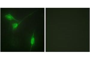 Immunofluorescence analysis of NIH-3T3 cells, using Akt (Phospho-Ser246) Antibody. (AKT1 anticorps  (pSer246))