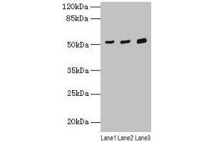 Western blot All lanes: CDR2 antibody at 4 μg/mL Lane 1: Mouse lung tissue Lane 2: Hela whole cell lysate Lane 3: HepG2 whole cell lysate Secondary Goat polyclonal to rabbit IgG at 1/10000 dilution Predicted band size: 52 kDa Observed band size: 52 kDa (CDR2 anticorps  (AA 1-454))