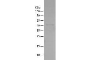 Western Blotting (WB) image for Flavin Containing Monooxygenase 2 (Non-Functional) (FMO2) (AA 43-249) protein (His-IF2DI Tag) (ABIN7122980)