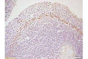 Formalin-fixed and paraffin embedded rat colon tissue labeled with Rabbit Anti-Leptin receptor(long) Polyclonal Antibody  at 1:200 followed by conjugation to the secondary antibody and DAB staining.