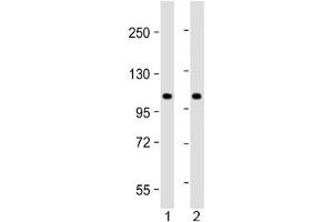 Western blot testing of human 1) lung and 2) HeLa lysate with NAT10 antibody at 1:2000.