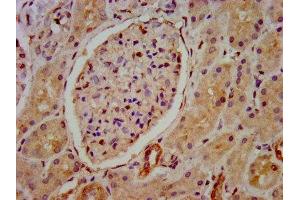 IHC image of ABIN7155939 diluted at 1:800 and staining in paraffin-embedded human kidney tissue performed on a Leica BondTM system.