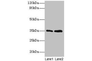 Western blot All lanes: GTF2B antibody at 2 μg/mL Lane 1: HepG2 whole cell lysate Lane 2: Hela whole cell lysate Secondary Goat polyclonal to rabbit IgG at 1/15000 dilution Predicted band size: 35 kDa Observed band size: 35 kDa (GTF2B anticorps  (AA 1-316))