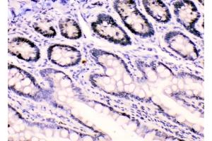 IHC analysis of HnRNPF using anti-HnRNPF antibody (ABIN4886622). (HNRNPF anticorps  (N-Term))